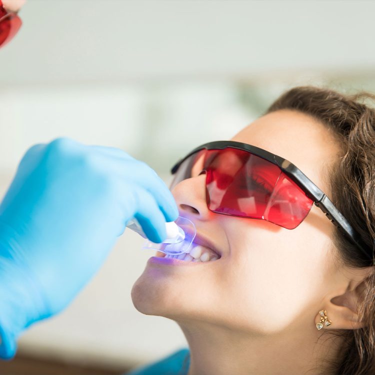 Blanchiment dentaire et soins esthétiques dentaires pour un sourire éclatant